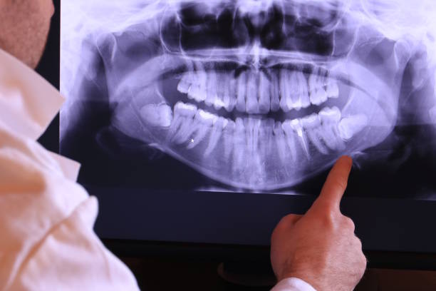 Best Emergency Dental Services for Seniors in Lake Dunlap, TX